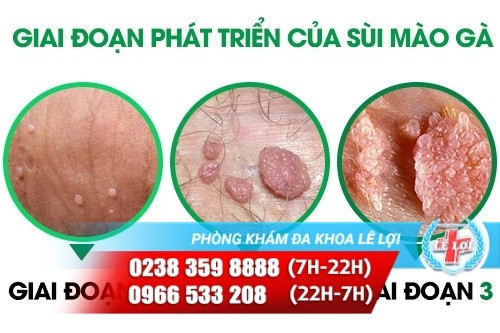 Anh 2 -hinh-anh-sui-mao-ga-phat-trien-qua-tung-giai-doan-2