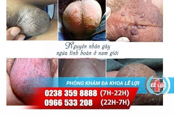 ngua-tinh-hoan