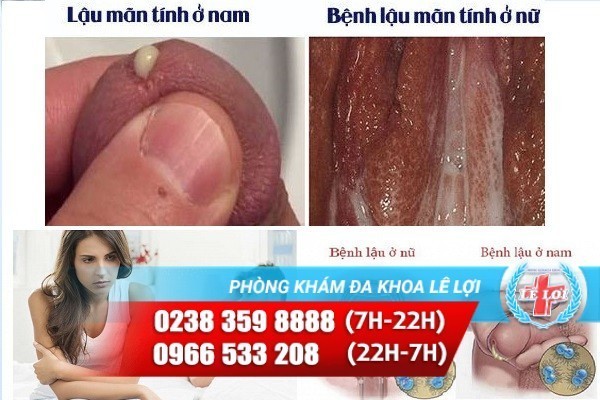 dau-rat-duong-vat-la-benh-gi