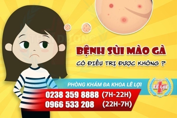 Bệnh sùi mào gà có điều trị dứt điểm được không?