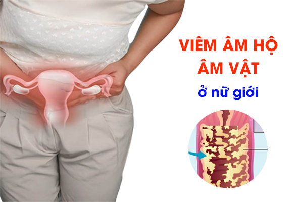 Viêm âm hộ, âm vật ở nữ giới