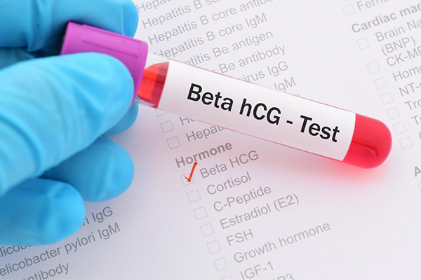 Xét nghiệm beta HCG là gì?