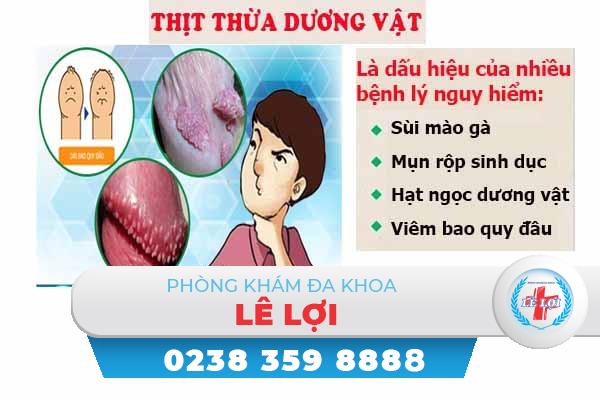 thit-thua-duong-vat